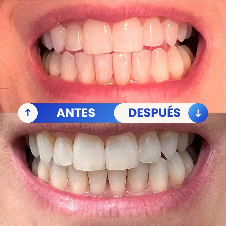 2x1 Tiras Blanqueadoras 3D Pro® – Luce Dientes Más Blancos en 30 Minutos