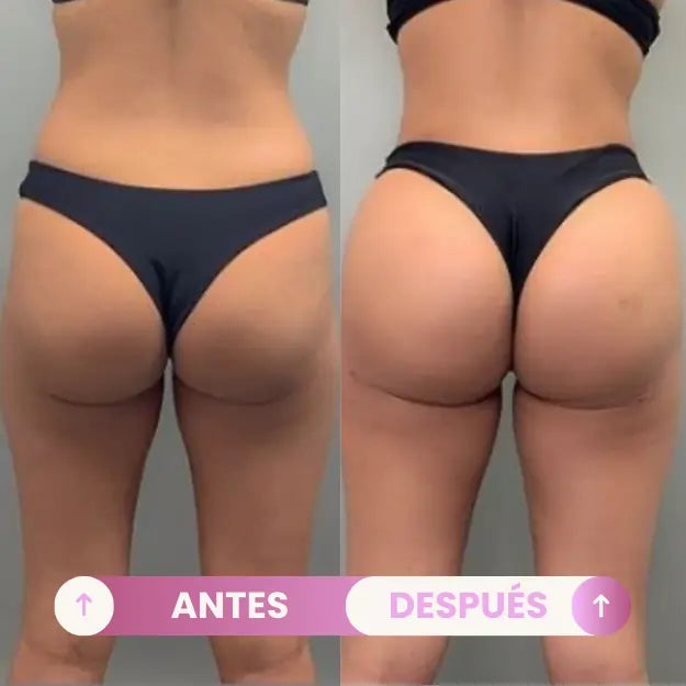 SIEMPREBELL® BBL Gummies | Tu Secreto para unas Curvas Perfectas 💖