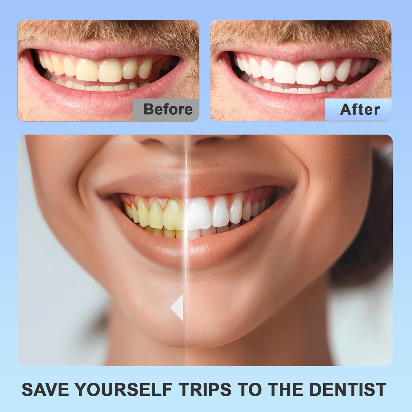 Tiras Blanqueadoras de Sonrisa Brillante™