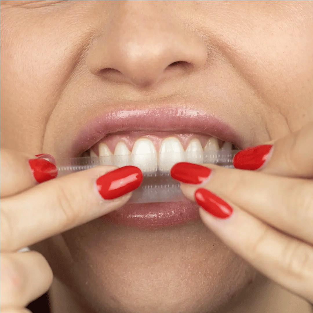 2x1 Tiras Blanqueadoras 3D Pro® – Luce Dientes Más Blancos en 30 Minutos