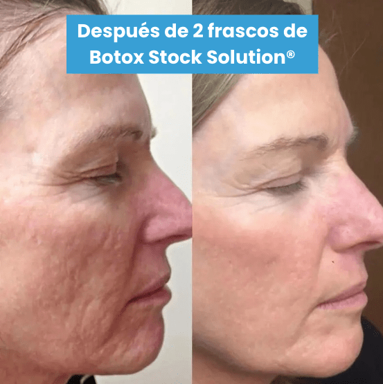 Serum Antiarrugas Botox Stock Solution® + ENVÍO GRATIS - GeekHub Shop