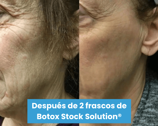 Serum Antiarrugas Botox Stock Solution® + ENVÍO GRATIS - GeekHub Shop