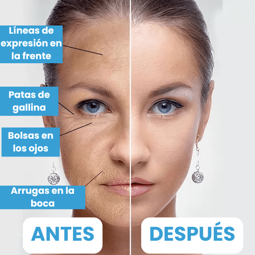 Serum Antiarrugas Botox Stock Solution® + ENVÍO GRATIS - GeekHub Shop