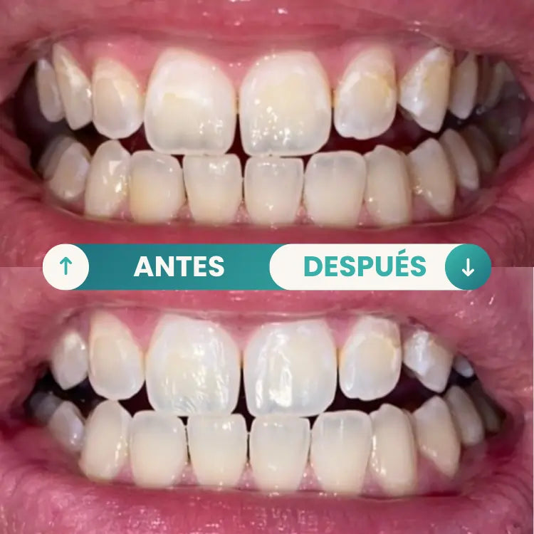 GuruNanda® Detox Bucal Natural + Raspador GRATIS | Recupera Tu Sonrisa