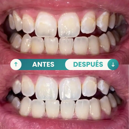 GuruNanda® Detox Bucal Natural + Raspador GRATIS | Recupera Tu Sonrisa