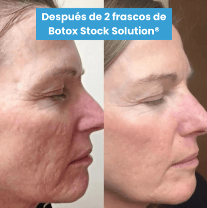 Serum Antiarrugas Botox Stock Solution® + ENVÍO GRATIS - GeekHub Shop