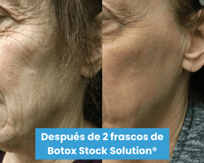 Serum Antiarrugas Botox Stock Solution® + ENVÍO GRATIS - GeekHub Shop